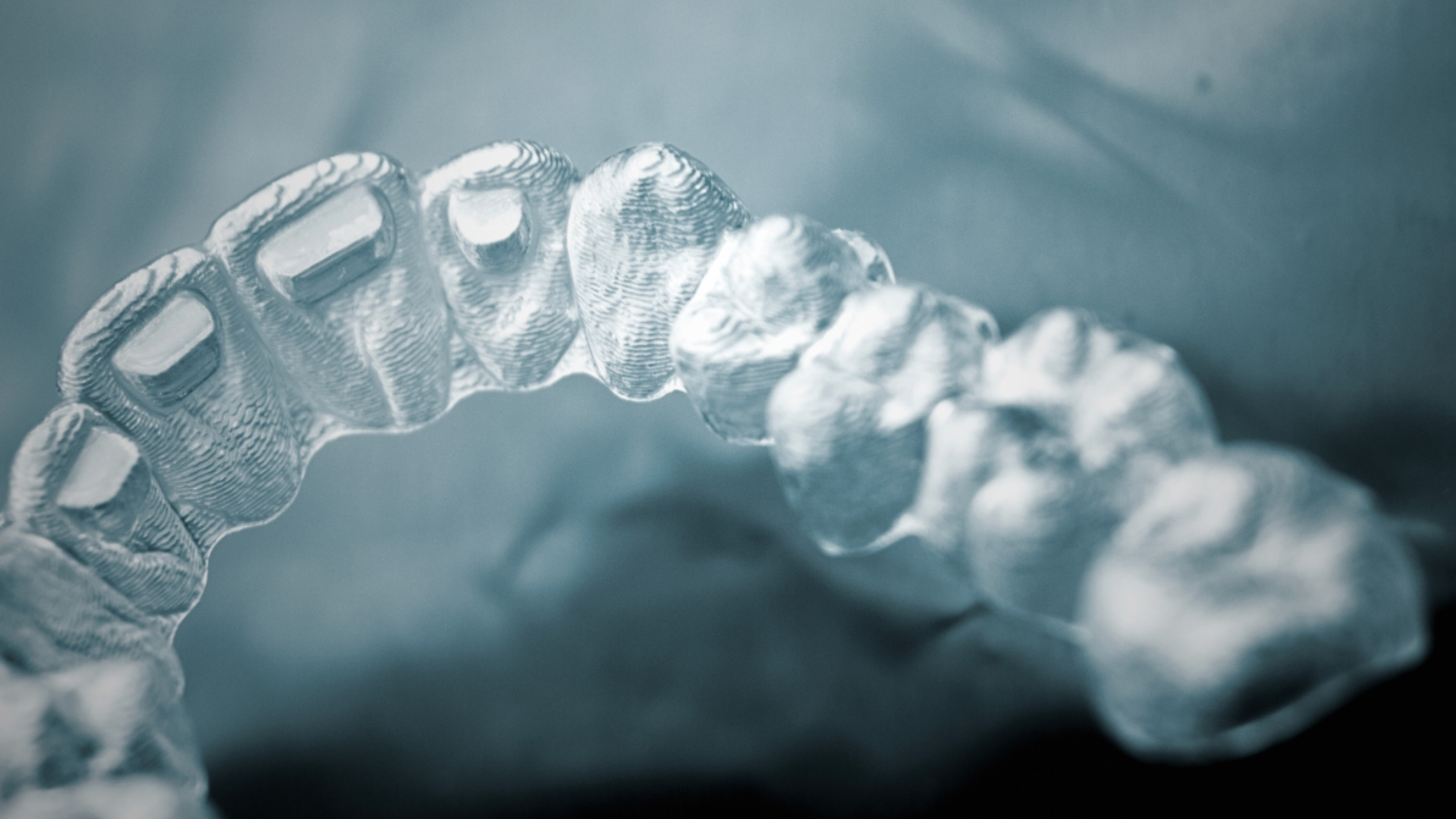 Invisalign in Geneva: A complete guide to clear aligners